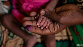 Les combats dans la région du Tigré (Ethiopie), combinés à la pandémie, la sécheresse et des invasions récurrentes de criquets, ont des conséquences désastreuses pour la population civile.